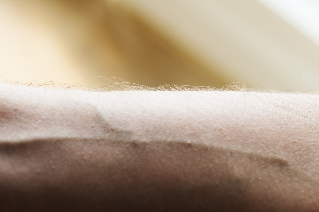 Why are my veins so visible